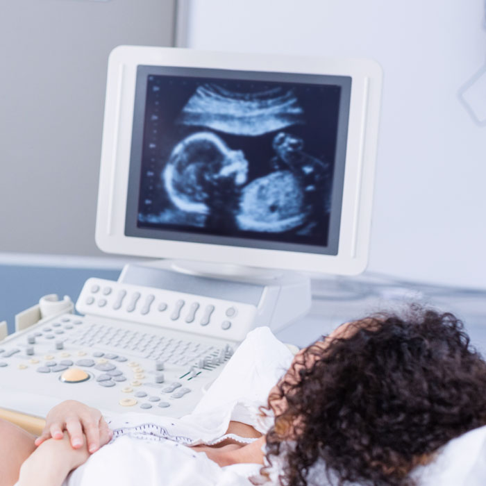 3D Sonography